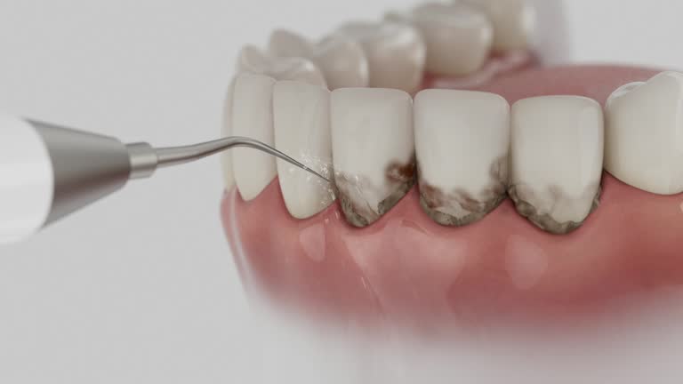 Reliable Dental contractor in Beulah, ND by Dentist Open Now